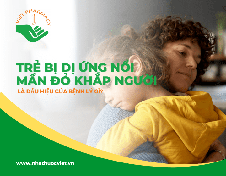 Trẻ bị dị ứng nổi mẩn đỏ khắp người là bệnh lý gì?